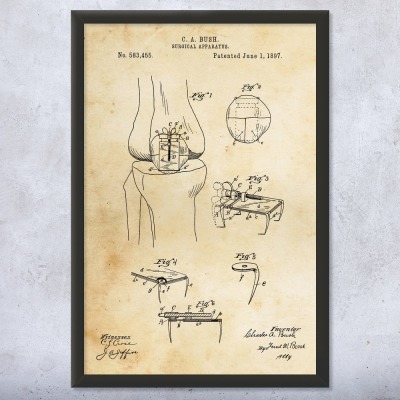 Bone Screw Patent Wall Art